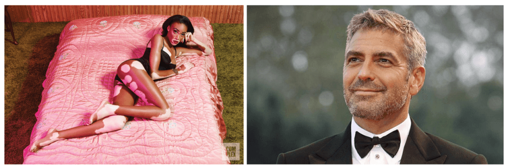 A la izquierda, Winnie Harlow nos muestra que la belleza no se mancha. A la derecha, con esa facha se nos vuela el George.