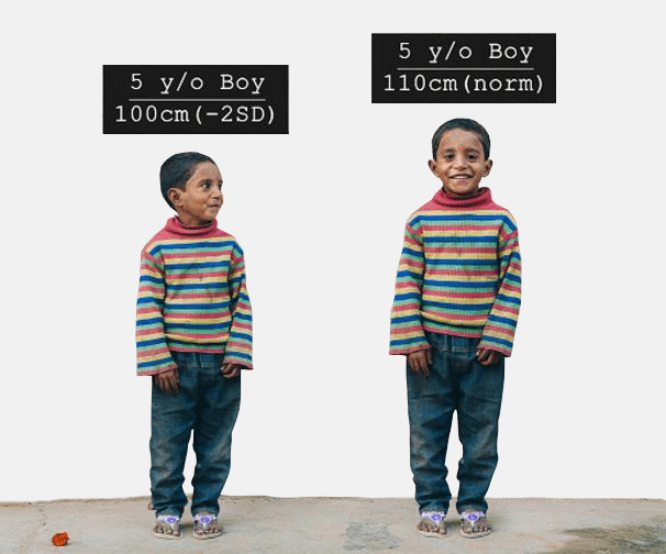 ‘Niño de 5 años comparado con su yo potencial’